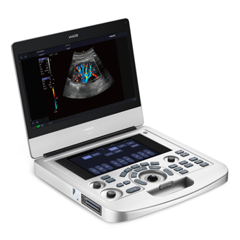 Edan Ultrasound Systems For Sale & Rental – Ultrasounds MD